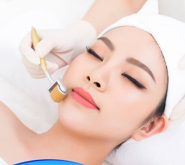 Lăn kim siêu vi điểm sẽ cải thiện làn da bị nám, sạm và tăng cường sản sinh collagen 