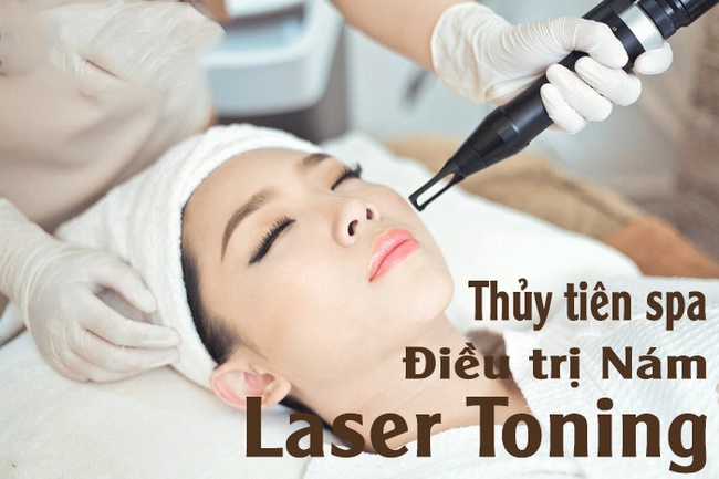 Trị nám - tàn nhang bằng công nghệ Laser Toning tại Thủy Tiên 