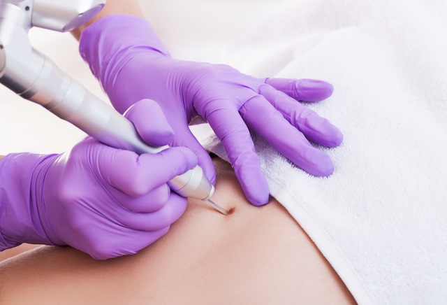 điều trị mụn cóc