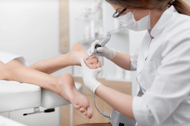 điều trị mụn cóc