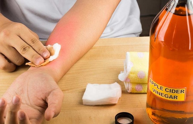 điều trị mụn cóc