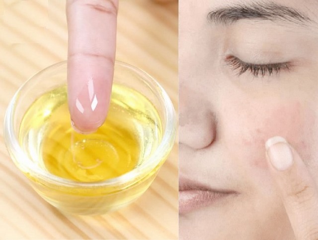  dầu oliu trị mụn 
