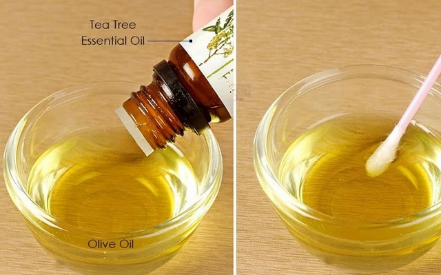  dầu oliu trị mụn 