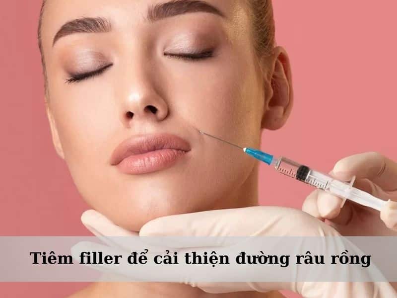 xóa bỏ đường râu rồng bằng việc tiêm filler