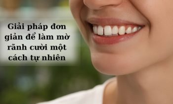 cách làm mờ rãnh cười an toàn