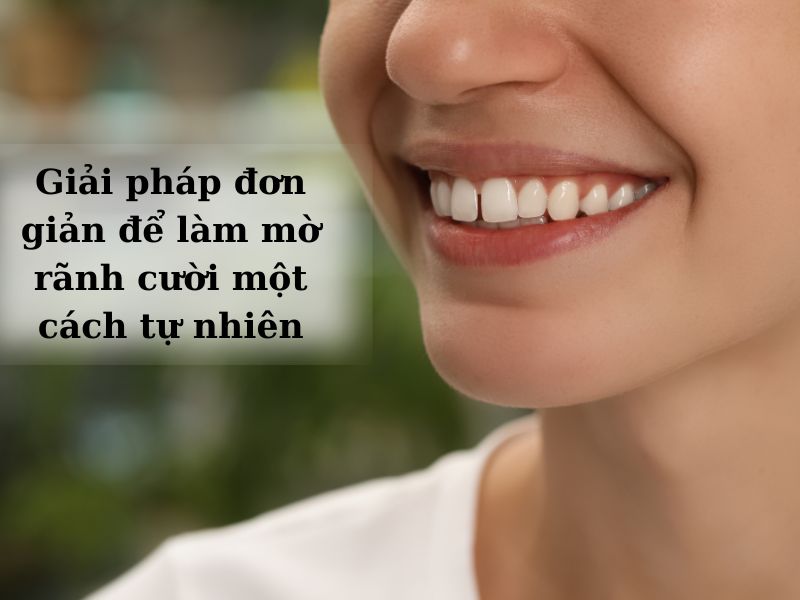 cách làm mờ rãnh cười an toàn 