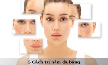 cách trị nám da bằng phương pháp tự nhiên