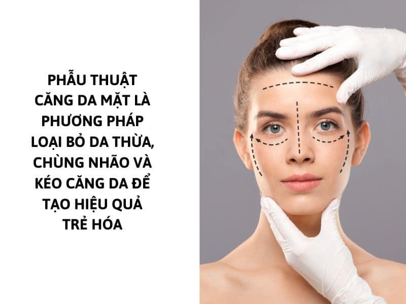 phẫu thuật giúp nâng cơ mặt