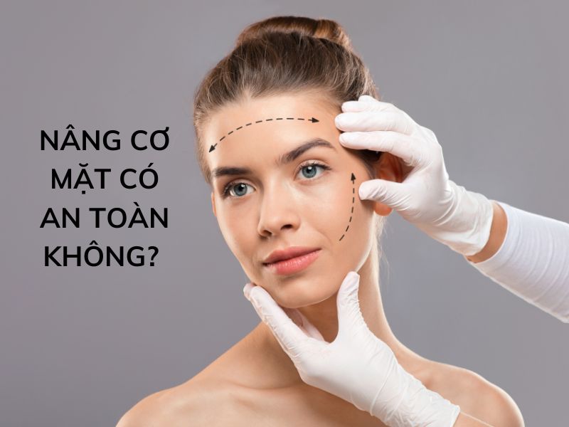 nâng cơ mặt có an toàn hay không