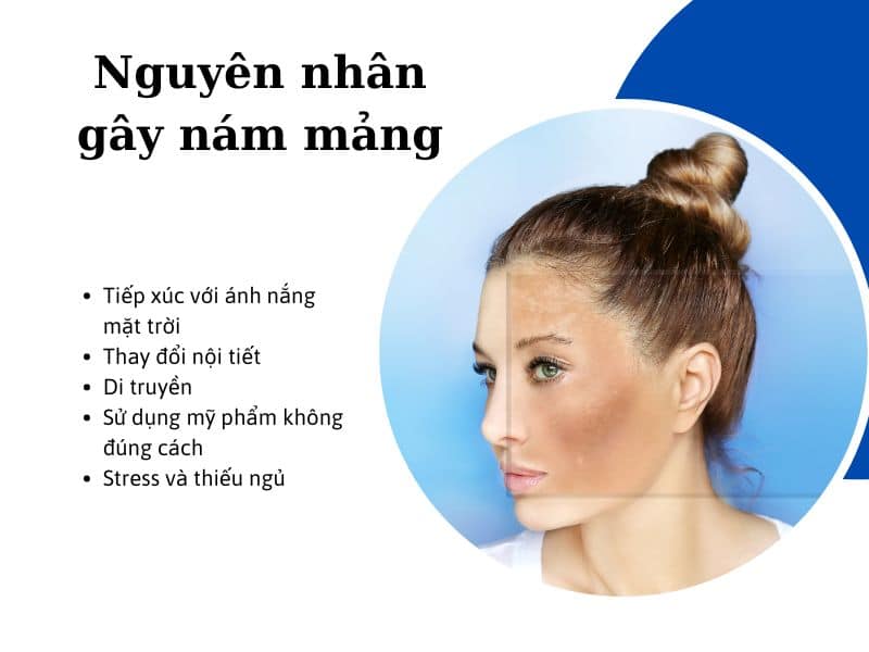 nguyên nhân gây ra nám mảng