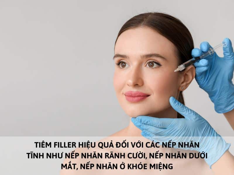 xóa nếp nhăn