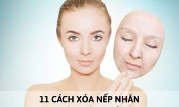 xóa nếp nhăn