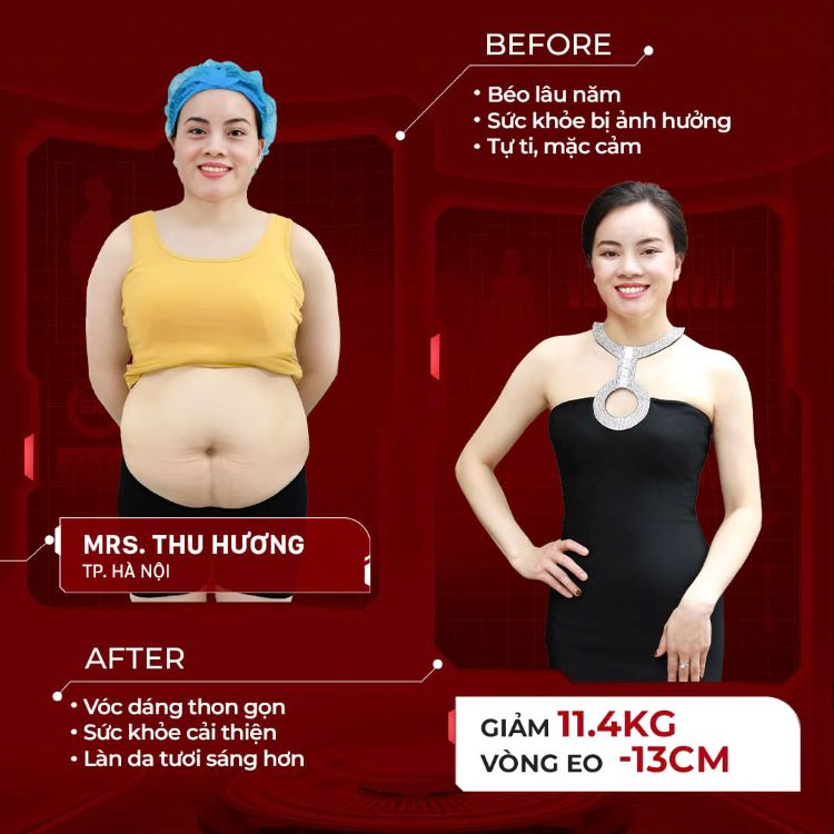 Hình ảnh trước và sau giảm béo của chị Hương 